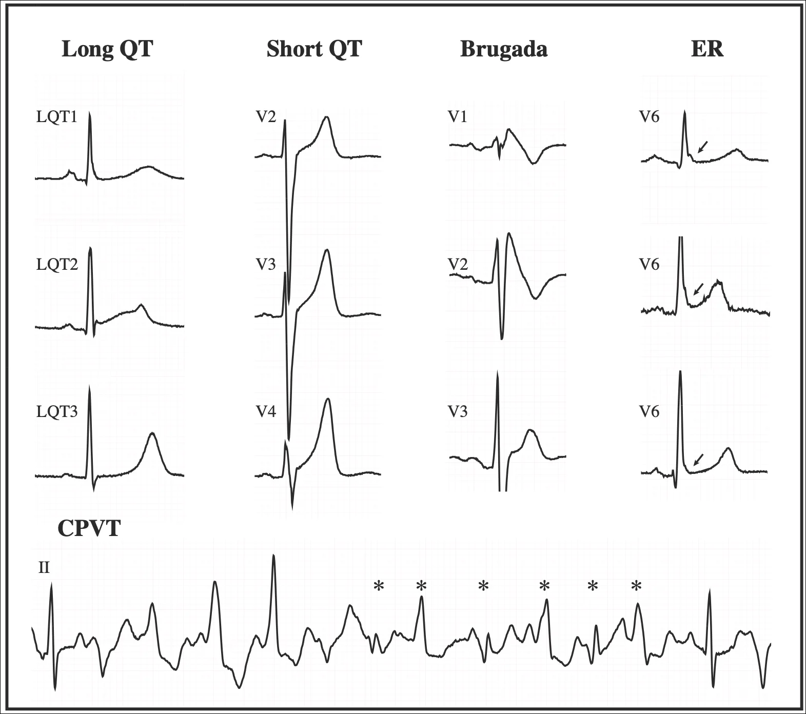 Cardiac Genetic Conditions